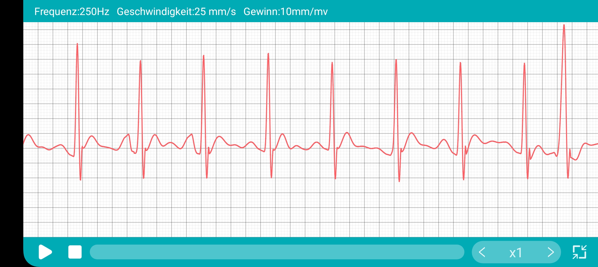 Du betrachtest gerade EKG ableiten mit einer Smartwatch